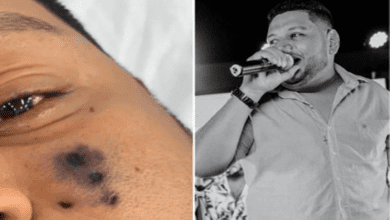 O cantor veio a óbito dias após ser picado por uma aranha no rosto. - Cantor morre após ser picado por aranha no rosto - Foto: Arquivo Pessoal